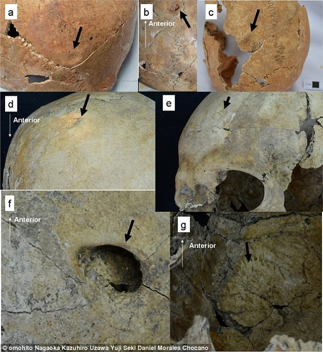 7 bộ xương 3.200 tuổi hé lộ về nghi lễ tàn bạo ở Peru