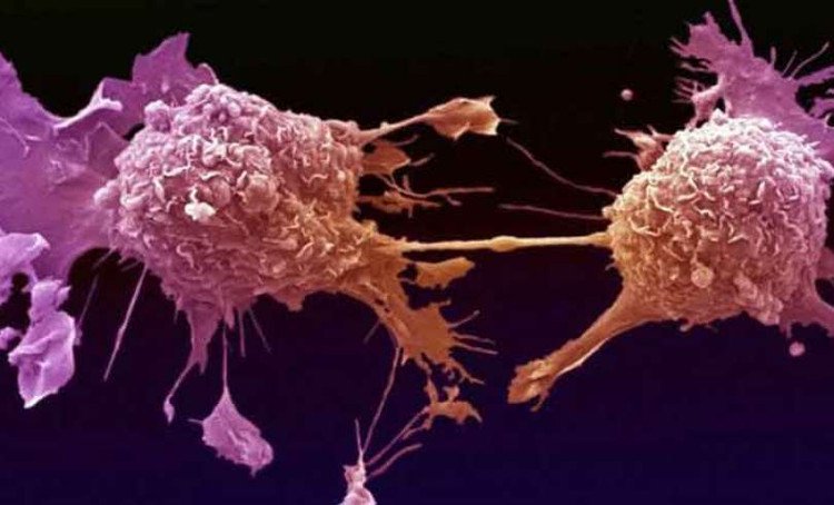 Bắt tế bào ung thư tự hủy - đột phá trong điều trị vấn nạn của thế kỷ