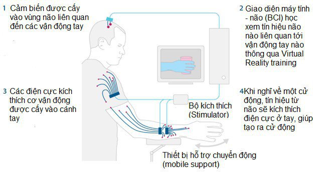 BCI (Brain Computer Interface): tương lai điều khiển máy móc bằng ý nghĩ