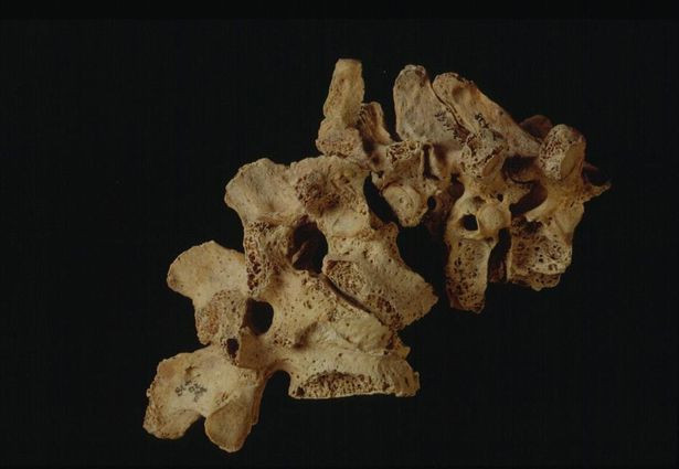Bí ẩn những bộ xương cốt bị đập vỡ tại một ngôi làng cổ nước Anh