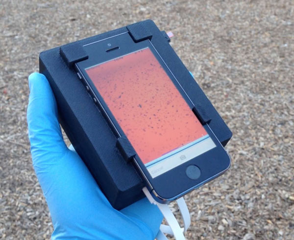 Biến điện thoại thông minh thành kính hiển vi phát hiện ký sinh trùng
