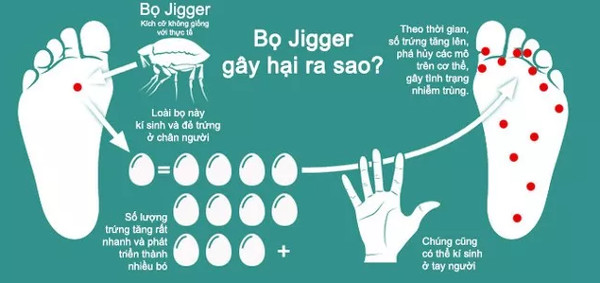 Bọ Jigger - Loài bọ cả đời bạn không muốn chạm trán