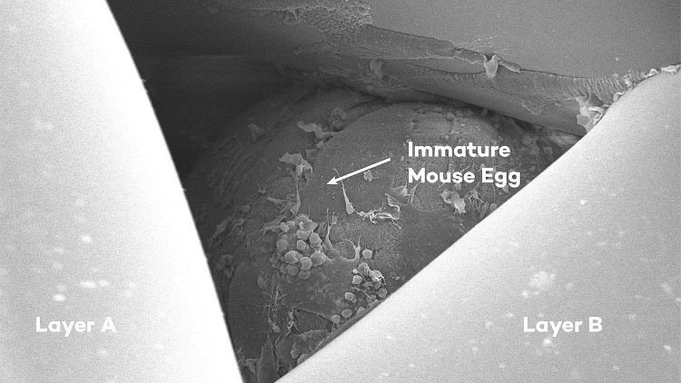 Buồng trứng in 3D mang lại hi vọng cho phụ nữ vô sinh
