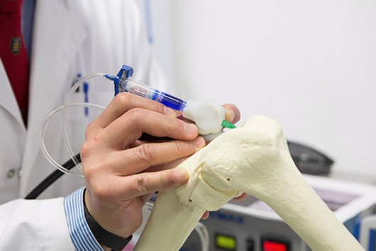Bút BioPen hỗ trợ tái tạo xương