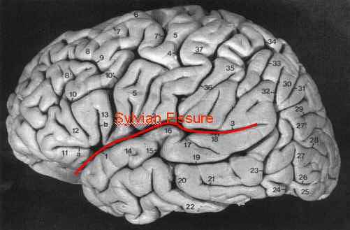 Các nhà khoa học đã làm gì với bộ não của Albert Einstein