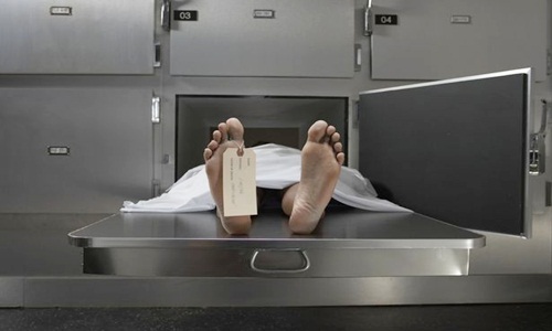 Cách khám nghiệm tử thi mới không cần mổ xác chết