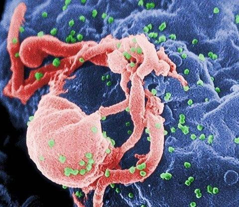 Cảm biến phát hiện virus HIV bằng mắt thường