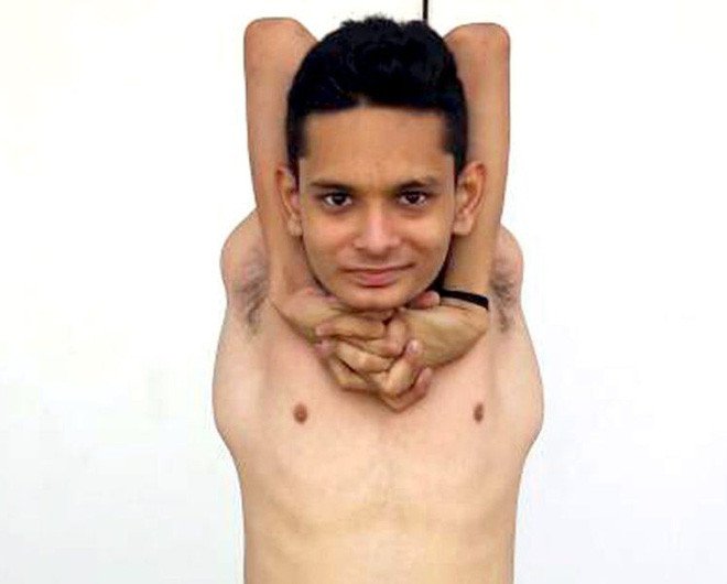 Chàng trai Ấn Độ có cơ thể uốn dẻo như cao su, uốn vai 360 độ và xoay cổ 180 độ