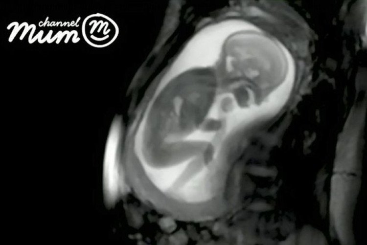 Công nghệ siêu âm rõ nhất thế giới giúp phát hiện những bất thường ở thai nhi