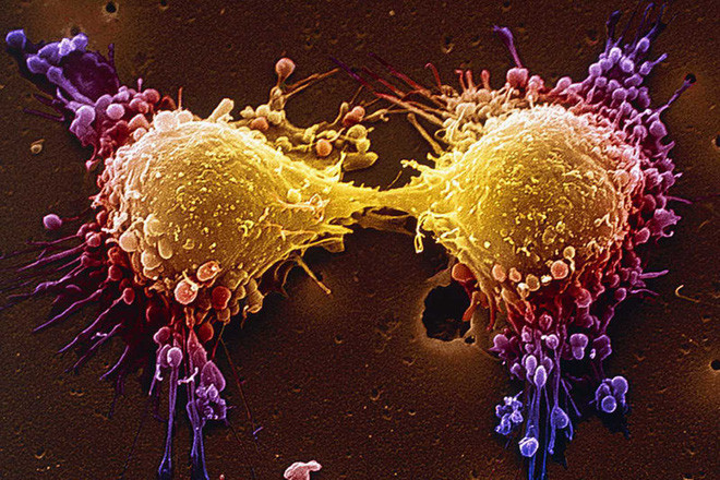 Liệu chúng ta có thể giết chết tế bào ung thư khi chúng đang ngủ?