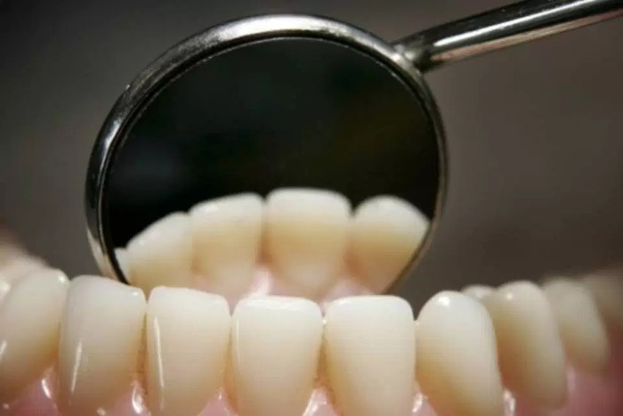 Loại thuốc chữa sâu răng mà không cần phải hàn răng