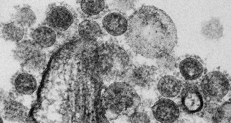 Mỹ bỏ lệnh cấm gây quỹ cho nghiên cứu các loại virus “chết người”