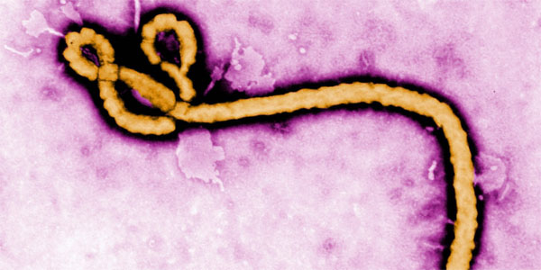Mỹ phát minh ra thiết bị có khả năng hút sạch Ebola