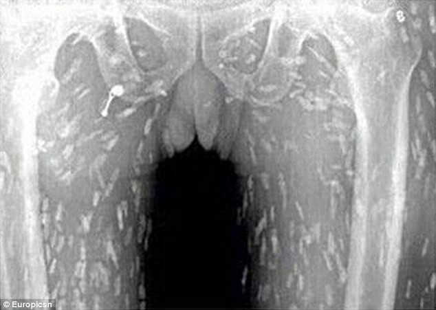 Người đàn ông ăn sashimi thấy ngứa da, chụp ảnh X-quang hình ảnh hiện ra đáng sợ