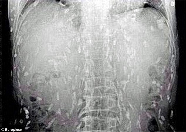 Người đàn ông ăn sashimi thấy ngứa da, chụp ảnh X-quang hình ảnh hiện ra đáng sợ