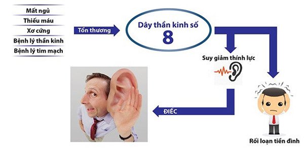 Nguyên nhân gây ù tai và cách điều trị