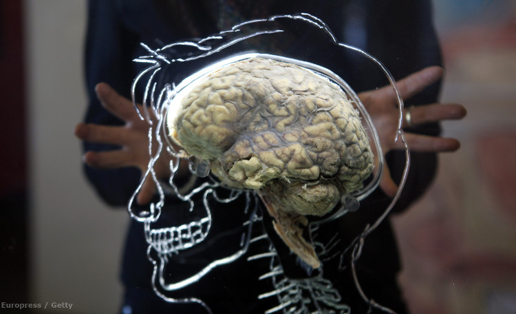 Nhà khoa học tuyên bố giúp người chết não sống lại