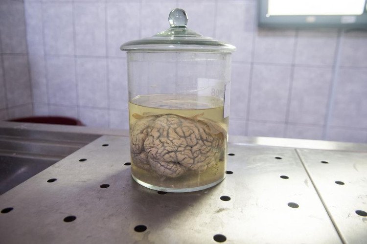 Quân đội Mỹ đầu tư 65 triệu USD để nghiên cứu cấy ghép não