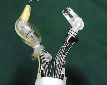 Robot cua giúp cắt sạch mô ung thư dạ dày