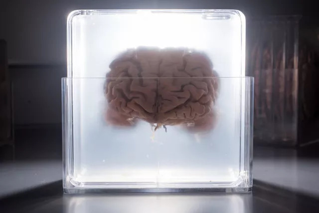 Số hóa não bộ như trong Ma Trận: Liệu viễn cảnh trên có xảy ra với nhân loại trong tương lai?