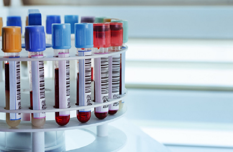 SoftBank và nhiều công ty khác đầu tư tiền tỉ vào công nghệ xét nghiệm ung thư bằng máu