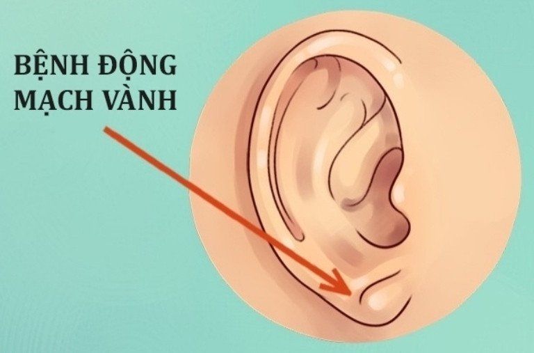 Sự thật thú vị về đôi tai hầu hết mọi người không biết