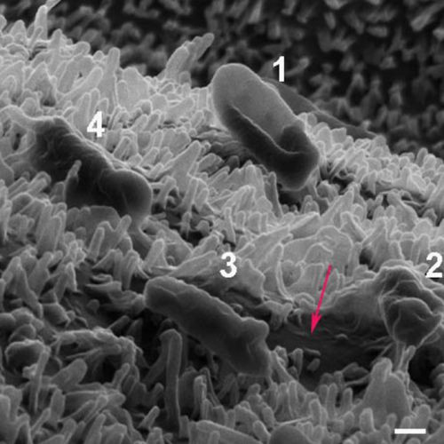 Tác dụng kháng khuẩn kỳ lạ của cánh chuồn chuồn