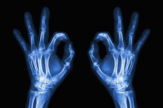 Tấm ảnh X-quang đầu tiên đã khiến vợ nhà phát minh ra nó phải giật mình
