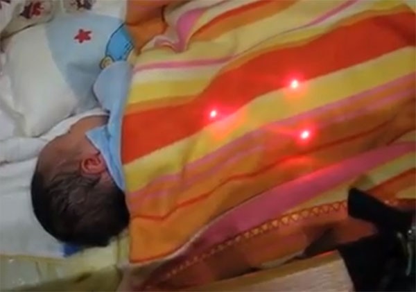 Thiết bị laser theo dõi giấc ngủ của trẻ sơ sinh