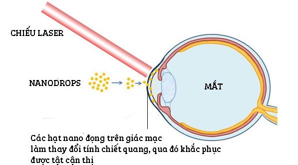 Thực hư thông tin thuốc nhỏ mắt của Israel chữa được cận thị