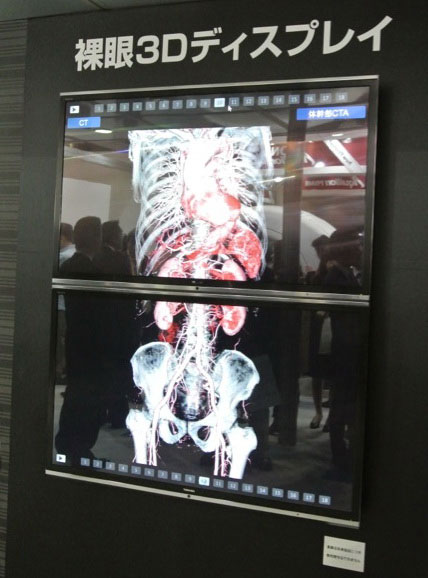Toshiba giới thiệu công nghệ đột phá về thiết bị y tế