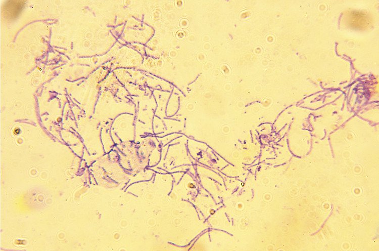 Vi khuẩn bệnh than - vũ khí sinh học đáng sợ!