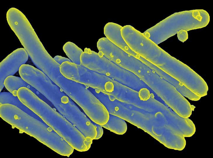Vi khuẩn cổ đại gây bệnh phong đang đột biến điên cuồng đề kháng với kháng sinh