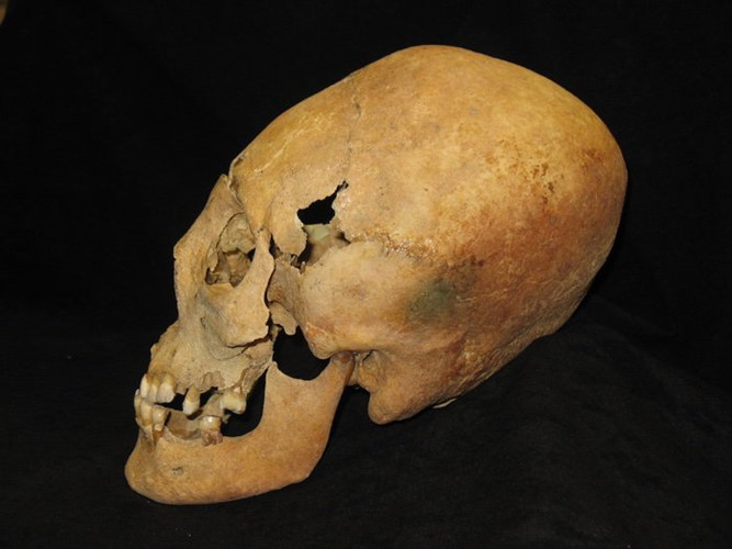 Vì sao phụ nữ Trung cổ có hộp sọ giống người ngoài hành tinh?