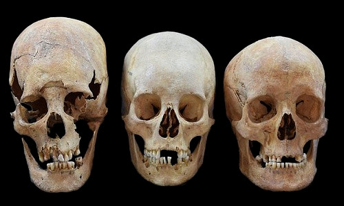 Vì sao phụ nữ Trung cổ có hộp sọ giống người ngoài hành tinh?