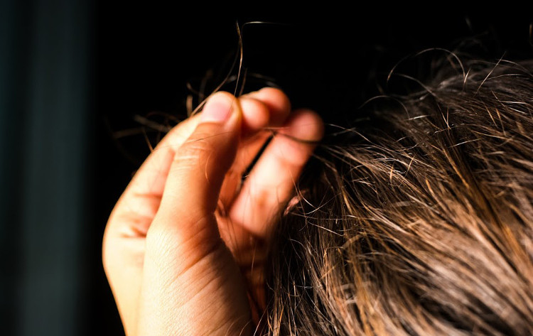 Video: Hội chứng khiến nhiều người nghiện nhổ lông, tóc