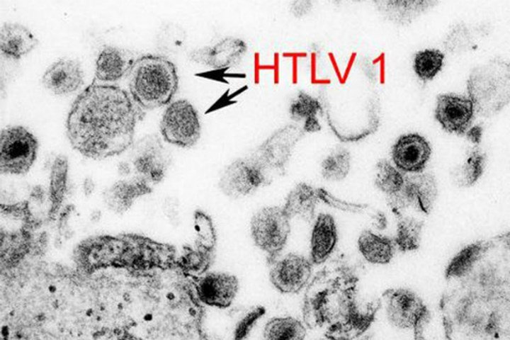 Virus cổ xưa có họ hàng với HIV đột nhiên trỗi dậy