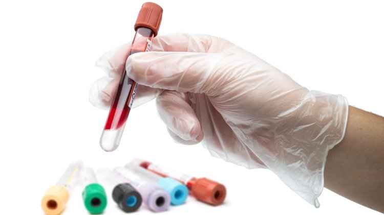 Xét nghiệm máu có thể biết được những bệnh gì?