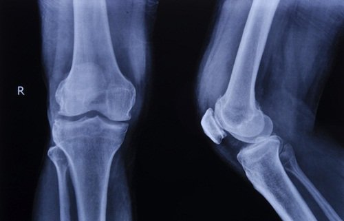 10 điều lý thú về bộ xương người