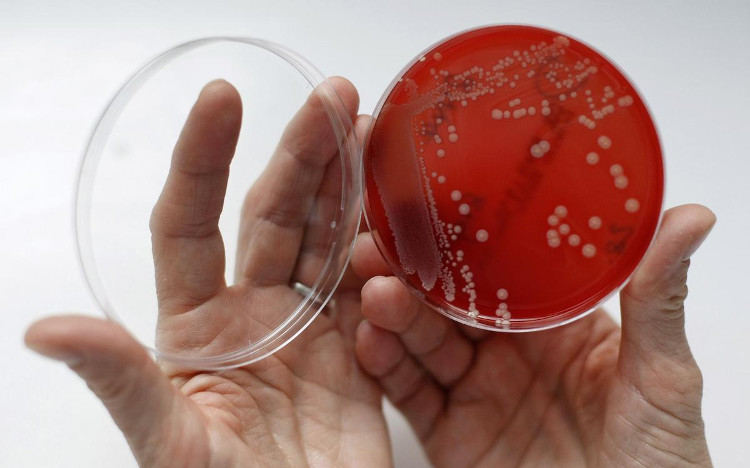 10 triệu Bảng Anh cho ai tìm được giải pháp chống lại kháng kháng sinh