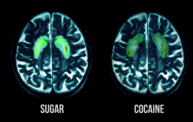9 điều thực sự xảy ra bên trong cơ thể khi bạn ăn quá nhiều đường