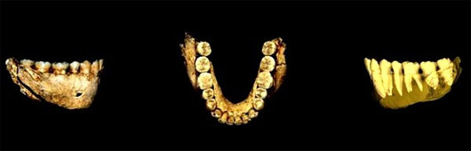 Bằng chứng cho thấy người cổ đại đã biết dùng tăm để xỉa răng