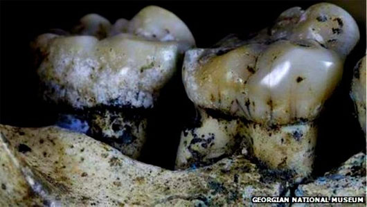 Bằng chứng cho thấy người cổ đại đã biết dùng tăm để xỉa răng