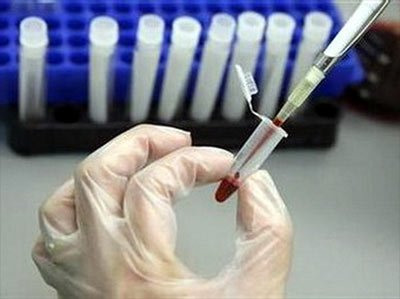 Bào chế thành công văcxin chống HIV