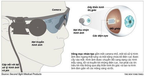 Bùng nổ công nghệ phục hồi thị lực người khiếm thị