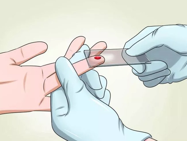 Cách chẩn đoán, điều trị và dự phòng bệnh sốt rét