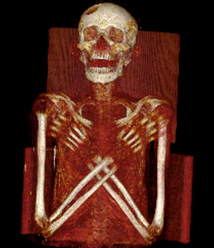 Căn bệnh kinh khủng trên xác ướp Ai Cập cổ đại