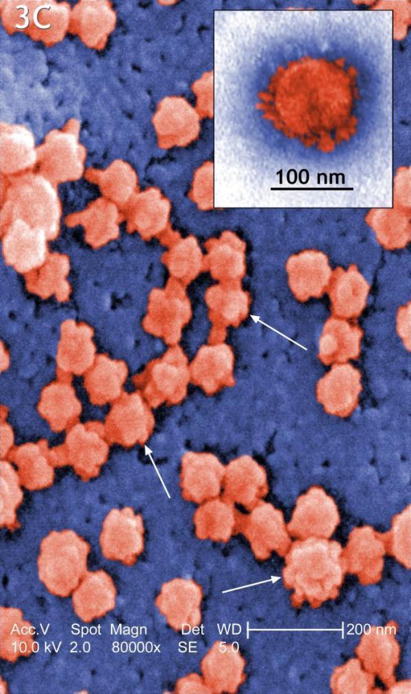 Chỉ cần một phân tử virus là đủ để gây ra bệnh truyền nhiễm