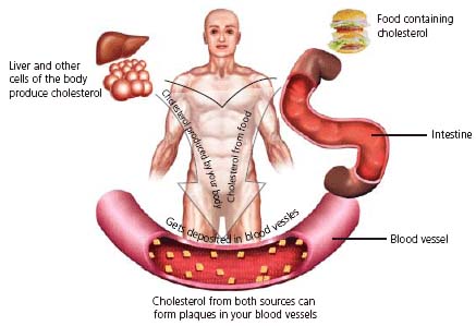 Cholesterol HDL giúp giảm nguy cơ ung thư ruột