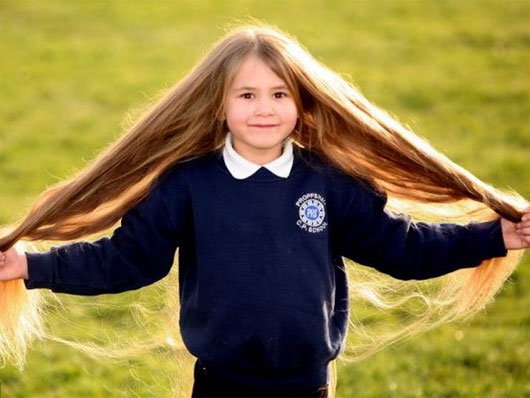 Cô bé mắc bệnh lạ khiến tóc mọc dài như Rapunzel